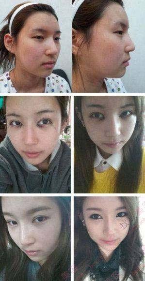 韩国整容医生爆料视频,揭秘整形手术背后的真相  第1张